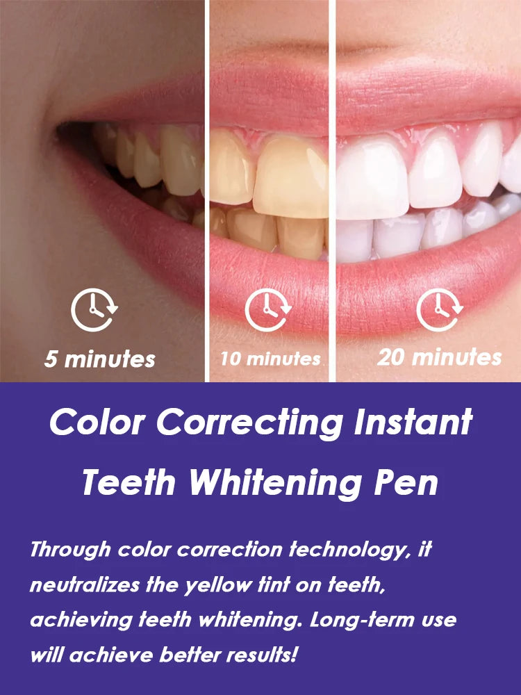 Instant Teeth Whitening Pen